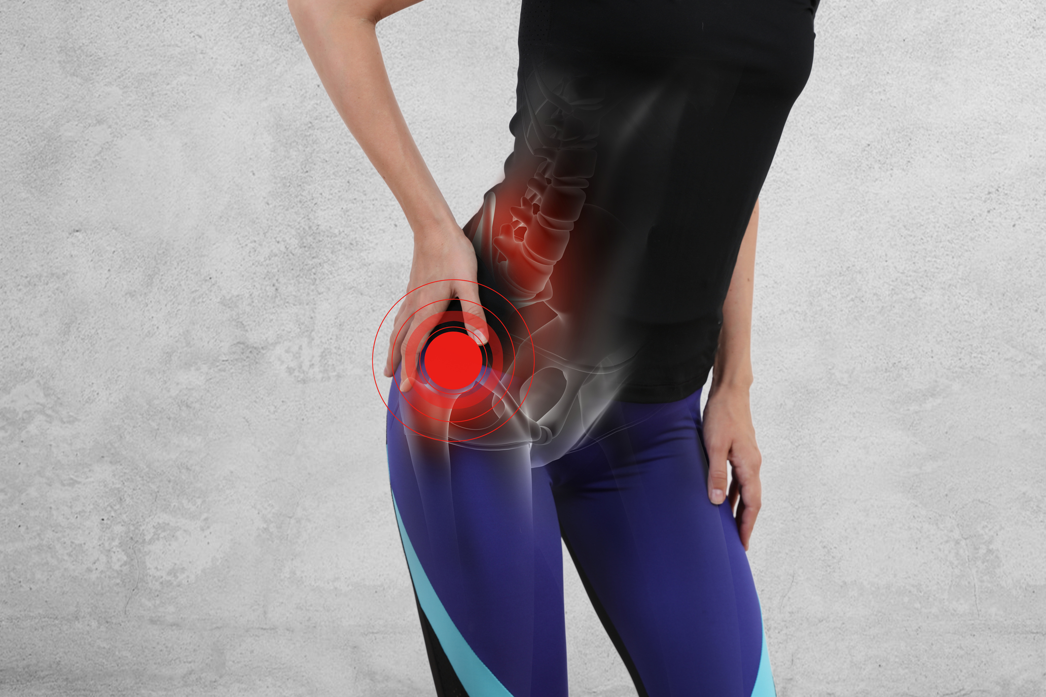 Treating a Labral Tear in the Hip: Your Path to Recovery