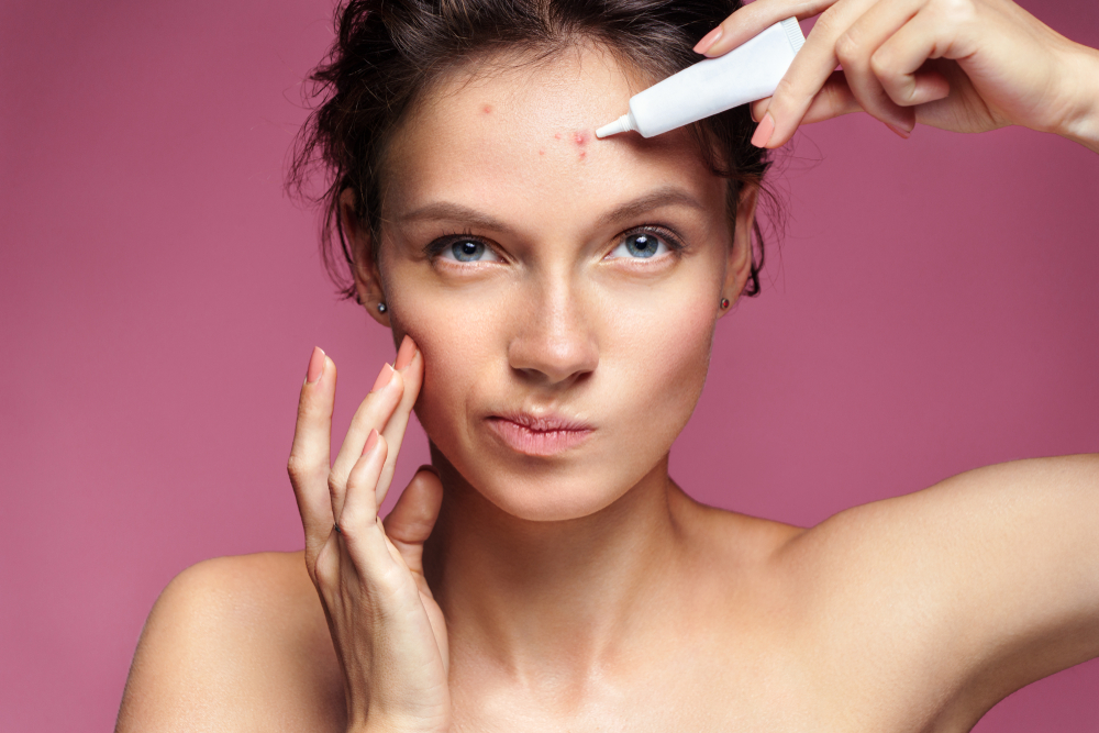 Coping Strategies for Acne-Related Anxiety | Surgical Arena Ltd